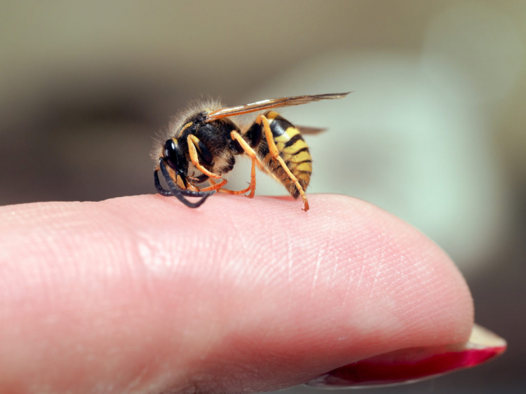 A wasp sting is painful, but only really dangerous if you are allergic